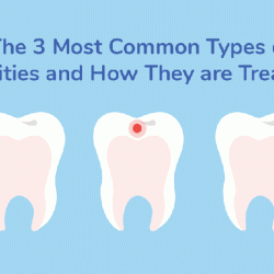 Cavity know if when slideshare don really